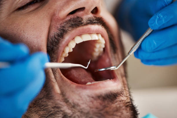 Best 24-Hour Emergency Dental Care in Foresthill, CA